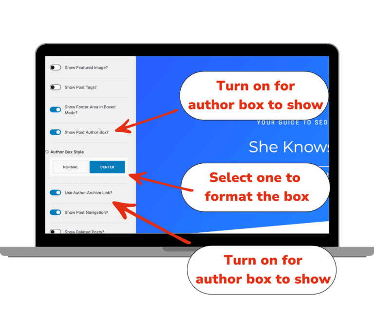 Screenshot of Kadence theme's customization options for author boxes in WordPress, highlighting the ability to show the author box, format the box style, and use the author archive link.